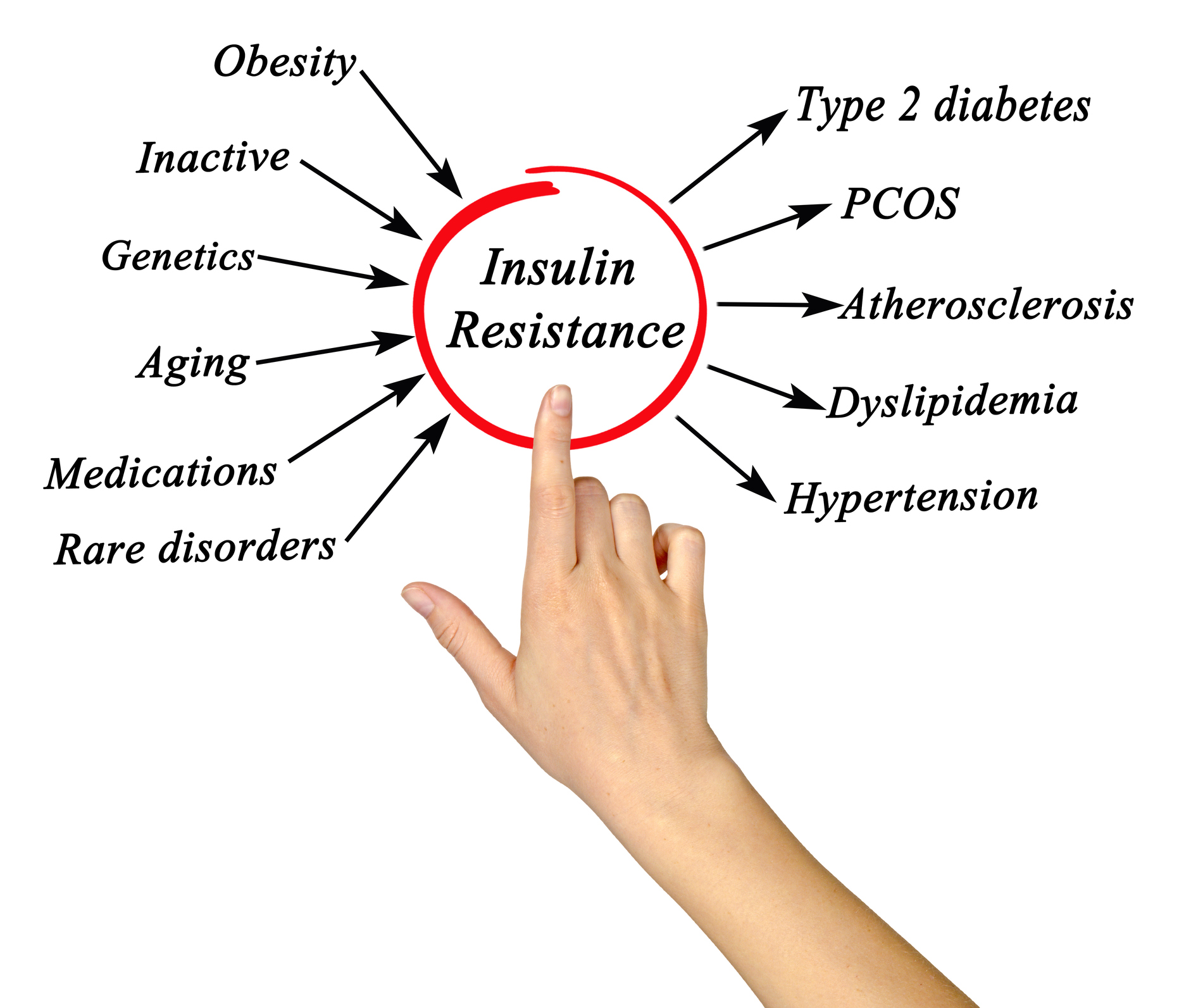 Insulineresistentie = prediabetes = glucose-intolerantie
