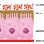 leaky gut